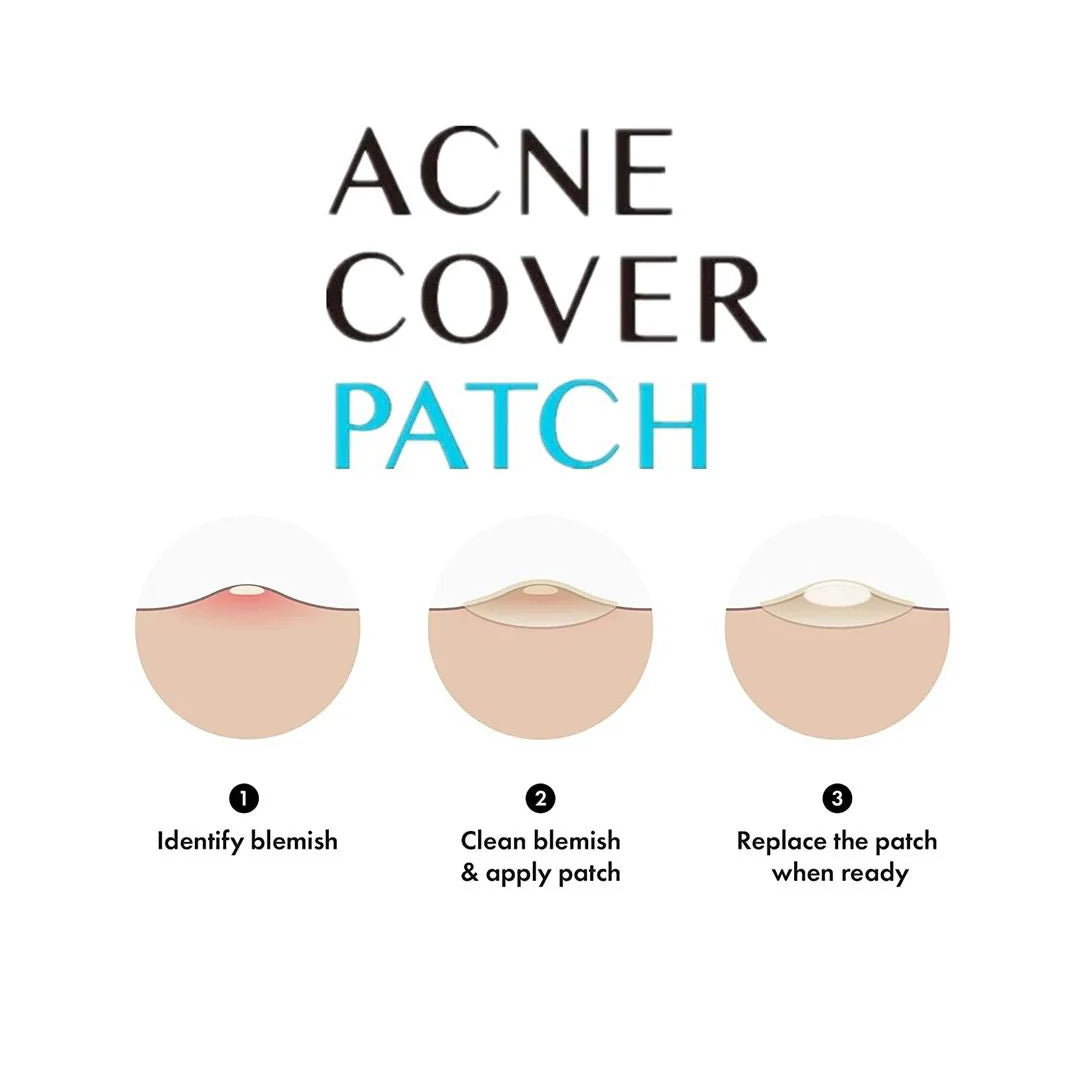 36 Acne Instant Remover Patches